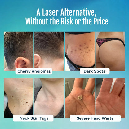 Advanced Blemish & Tag Eraser Pen
