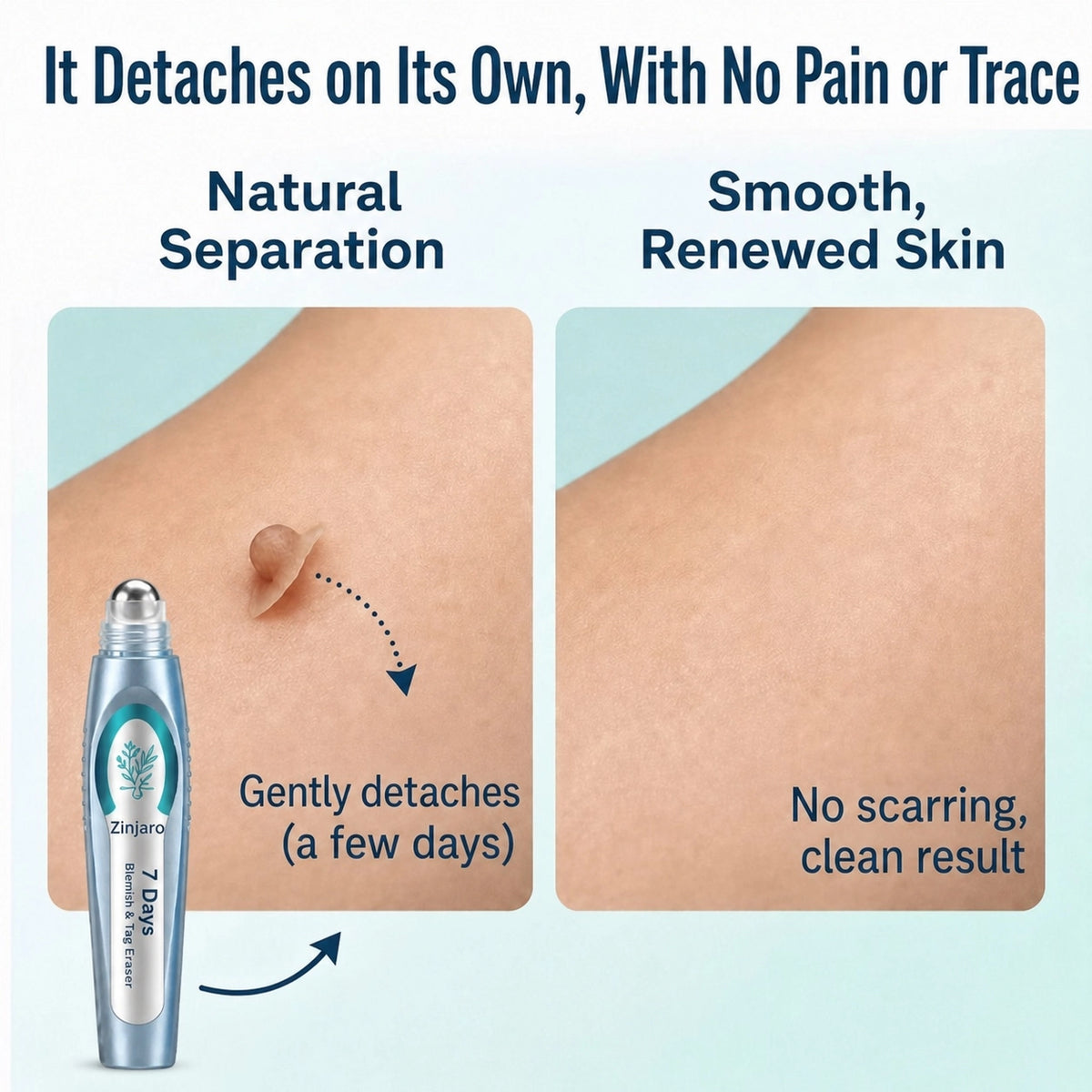 Advanced Blemish & Tag Eraser Pen