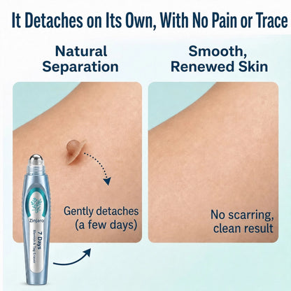 Advanced Blemish & Tag Eraser Pen